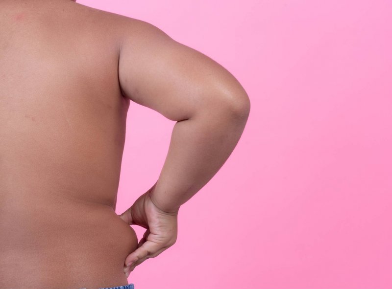 obesidad infantil